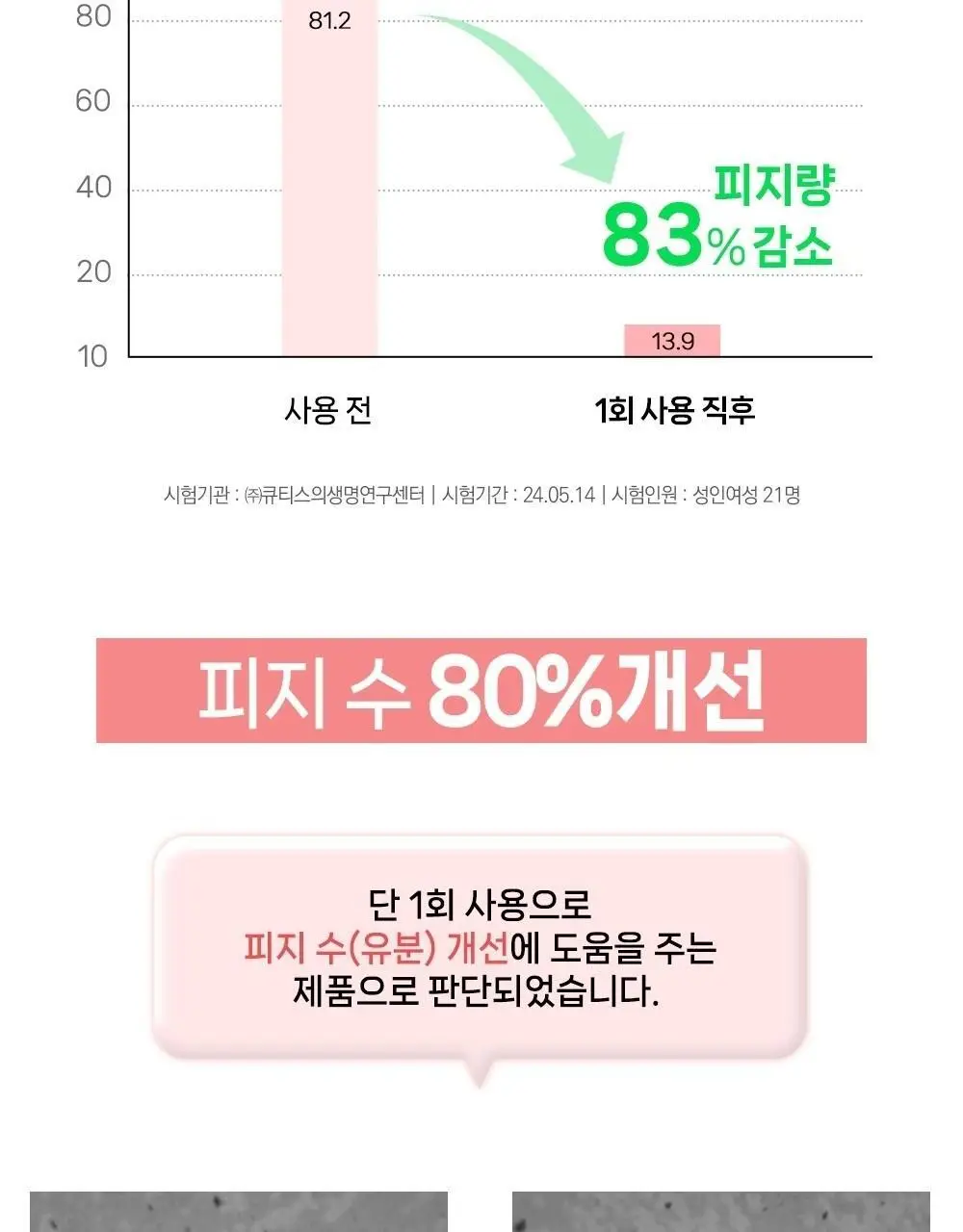 [여드름기능성/약알칼리성] 아토뮤 아크리스 폼클렌저 120ml 상세페이지 13